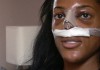 Bleach, Nip, Tuck: The White Beauty Myth