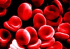 Autopsy: Emergency Room Massive Blood Loss