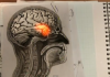 The Creative Brain How Insight Works
